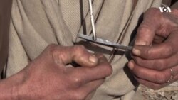 درملنه مې وشوه خو د بې کارۍ له امله مې بیا نشو ته مخه کړه – معتاد 