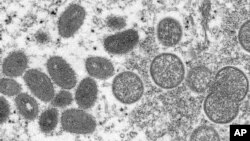 Mikroskopski prikaz virusa koji izaziva majmunske boginje (Foto: AP/Cynthia S. Goldsmith, Russell Regner/CDC)