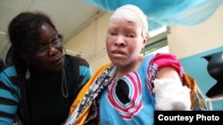 FILE - Maria Chambanenge, a woman with albinism shown in this undated photo, was reportedly attacked by five armed men, in Mkowe village, in Tanzania's Rukwa region, for her body parts.