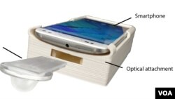 Fertilex is an inexpensive smartphone attachment that quickly and accurately evaluates semen samples for fertility testing. (M.K. Kanakasabapathy et al., Science Translational Medicine/2017)